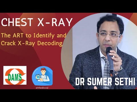 DAMS Interactive Class: Radiology| Art of Chest Xray Dr Sumer Sethi| NEET PG NEXT INI-CET MBBS