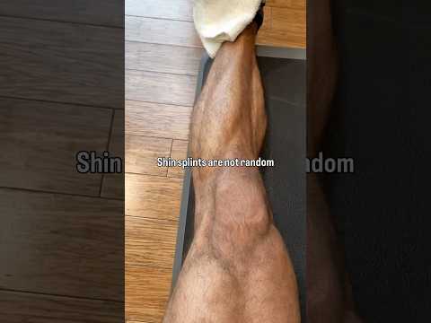 Shin Splint Solutions