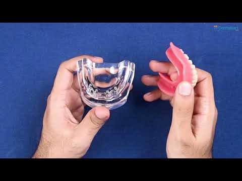iDENTical Implant Model With Silver Bar M6008 2
