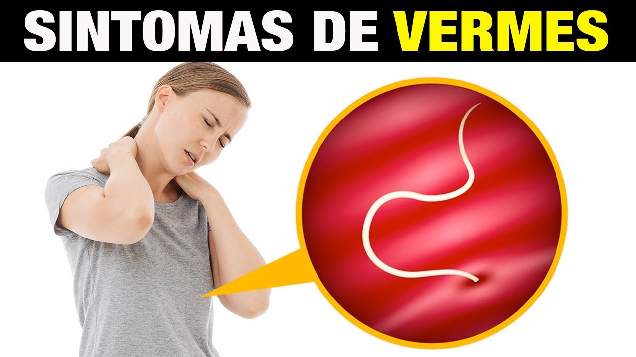 Sintomas de Vermes [SINAIS PERIGOSOS PARA PRESTAR ATENÇÃO]