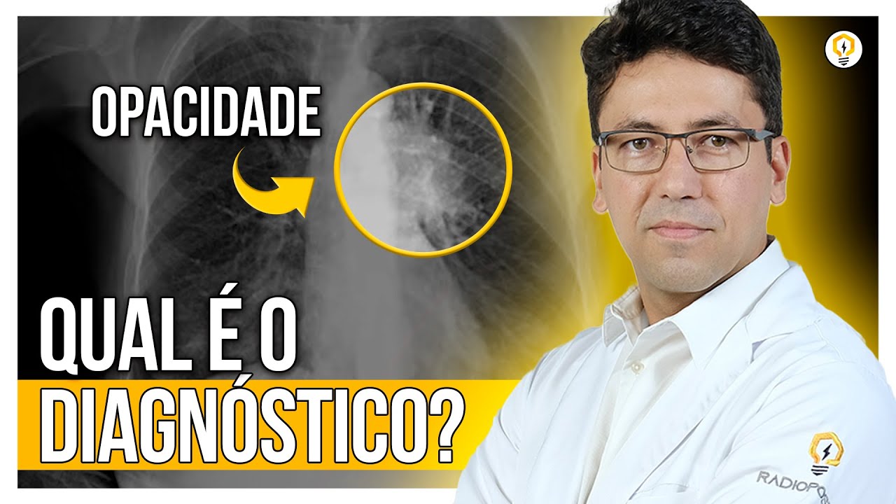 Topografia e DIAGNÓSTICO de Lesão em RAIO-X de Tórax