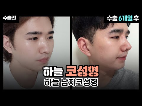 하늘성형외과