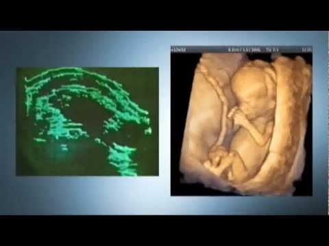 Geschichte der Ultraschallmedizin