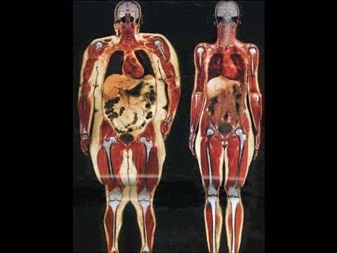 Lingh Zhi/ Reishi in der Therapie und gegen Zivilisationskrankheiten