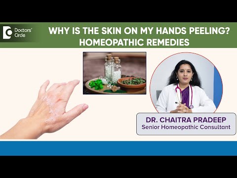 Homeopathic Treatments for Dry, Itchy, Cracked Hands   - Dr. Chaitra Pradeep | Doctors' Circle