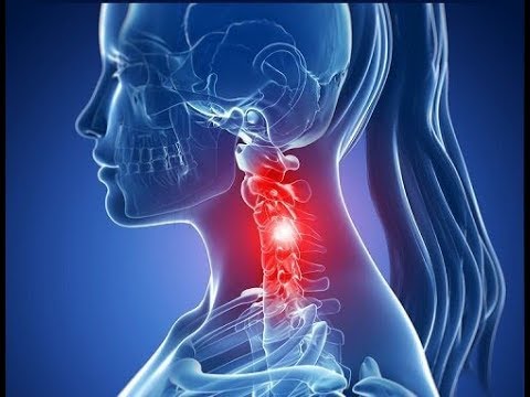 Gomito prezzo benda Osteocondrosi della colonna cervicale vertigini debolezza