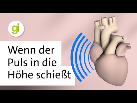 Plötzlicher, sehr schneller Herzschlag: Was ist anfallsartiges Herzrasen?