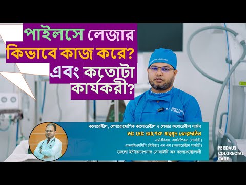 পাইলসে লেজার কিভাবে কাজ করে এবং কতটা উপযোগী?