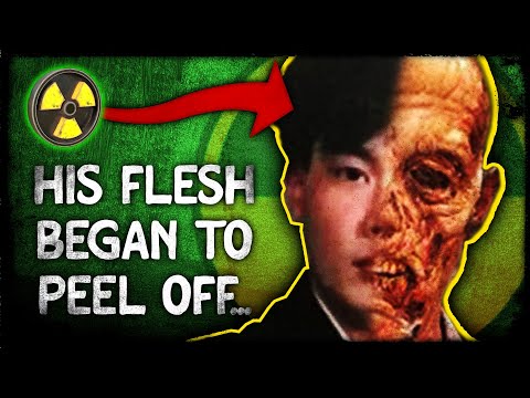 The Man Who Cried Blood -  Hisashi Ouchi's Slow and Gruesome D*ath