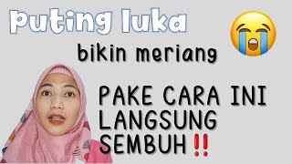 Download lagu SORE NIPPLES | HERE'S AN EFFECTIVE WAY TO TREAT THEM mp3 Download lagu SORE NIPPLES | HERE'S AN EFFECTIVE WAY TO TREAT THEM mp3