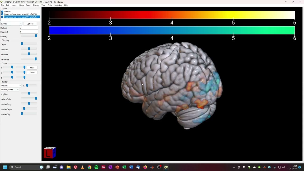 fMRI Analysis: Visualization