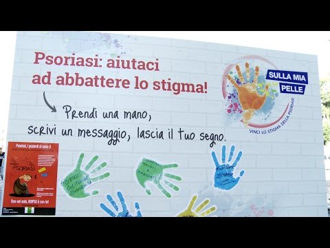 Mezzi israeliani di psoriasi Pazienti di attori con psoriasi