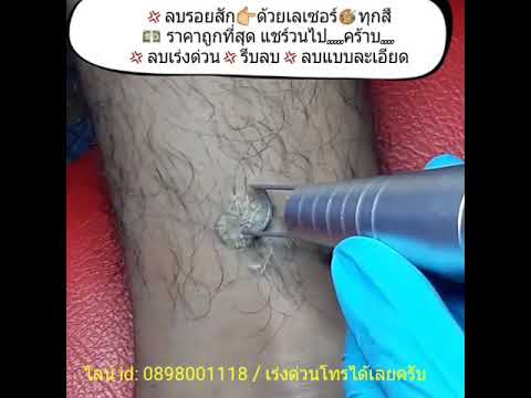 1 กิโลกรัมกระเทียมแรง พวกเขากินเพื่อเพิ่มความแข็งแรง