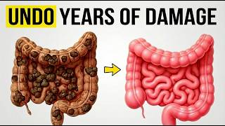 Gut Detox: How To Repair & Clean Your Gut Naturally