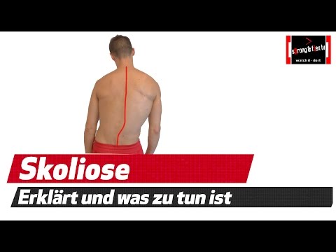 Wie auf der Halswirbelsäule Elektrophorese Schmerzmittel von Gelenkschmerzen