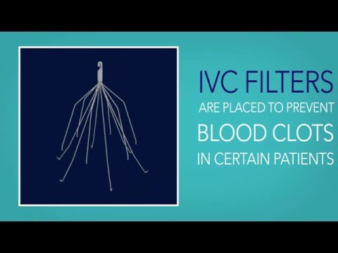 IVC Filters