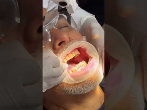 La Clave para un Diseño de Sonrisa Excelente: Consejos de la Dra. Patricia Otero en Barranquilla