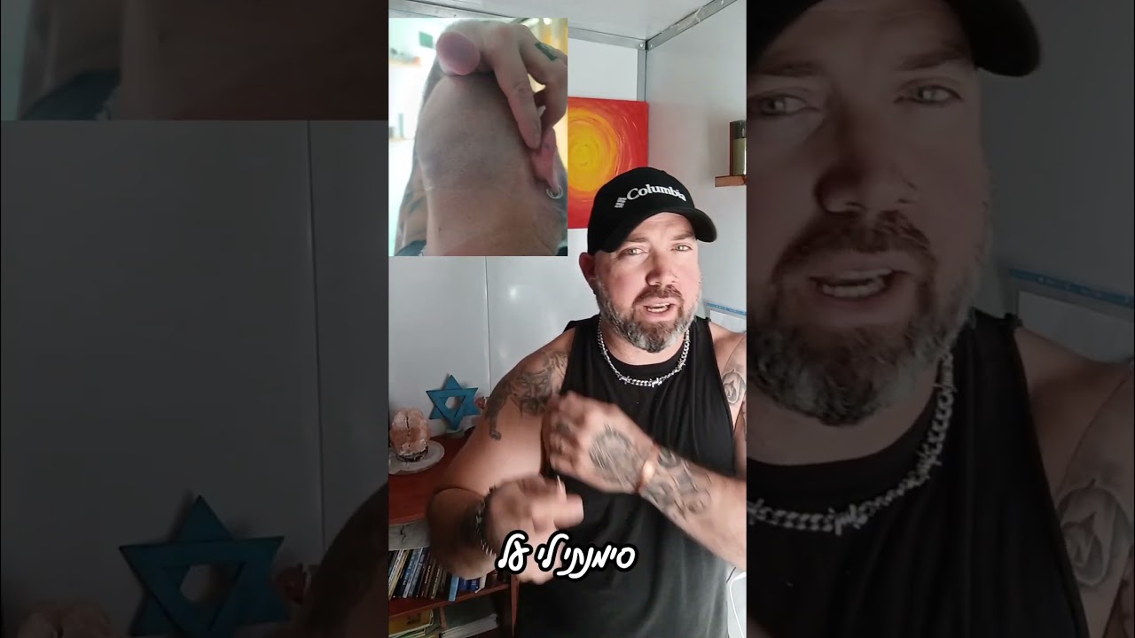 נקודת לחיצה לכאבים באוזן ימין thumbnail