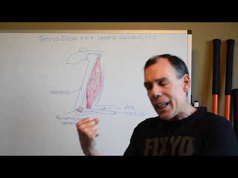 Scottsdale Arizona Medical Personal Trainer - The Cure For Tennis Elbow is Misleading!