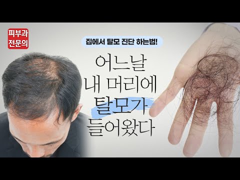 나도 슬슬 탈모가 시작되는건가 걱정되시는 분들에게... 집에서 최대한 정확히 탈모 진단해보는 방법 알려드립니다!