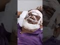 Ravi kumar famous tumor removal surgery - Before & After