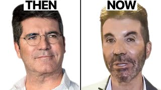 Simon Cowell NEW FACE | Plastic Surgery Analysis video