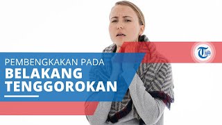 Faringitis, Pembengkakan pada Bagian Belakang Tenggorokan dan Biasa Terjadi saat Musim Hujan
