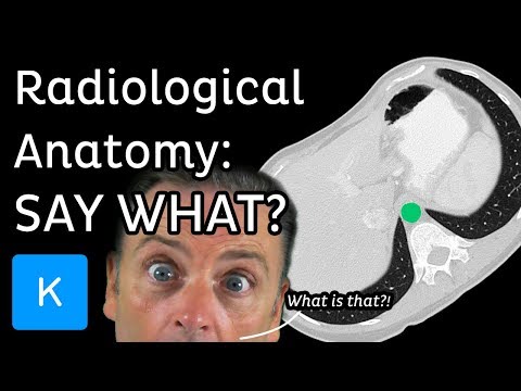 Radiological Anatomy: What is it? | Kenhub