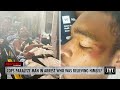 Cops PARALYZE Man Who Was Relieving Himself In Alley, Allegedly