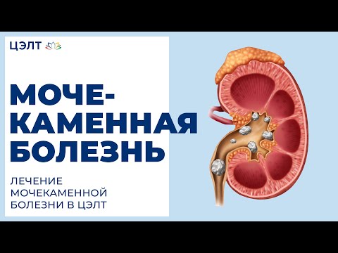 Узи шейных отделов позвоночника Гепатит с боль в спине