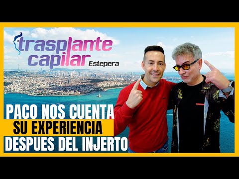 Paco Navarro habla de su injerto capilar en Clínica Estepera