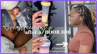 BREASTFEEDING AFTER A BOOB JOB - MILK PRODUCTION, STRUGGLES, HOW THEY LOOK POST OP VS. POSTPARTUM