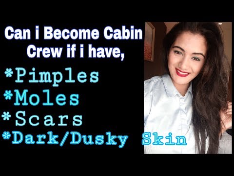 Can I become a Cabin Crew/Air Hostess if I have Moles, Pimples,Scars & Dark Skin Video