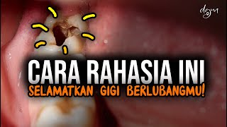 Download lagu Bukan DICABUT‼️Bukan DITAMBAL‼️ Ini Solusi Gigi Berlubang Sakit mp3