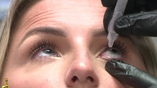 Eye lift without surgery