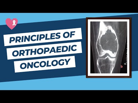 Principles of Orthopaedic Oncology