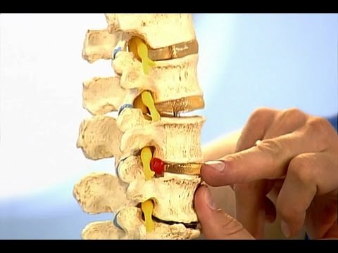 Какие обезболивающие уколы при боли в пояснице Аппликатор на суставы