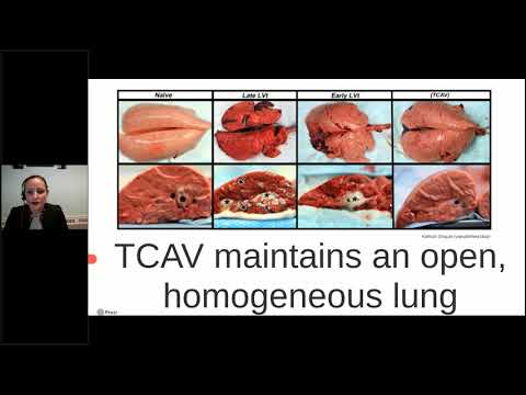 APRV in Pediatrics and Neonatology