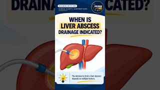 Indications of drainage of #liverabscess #pyogenic #amoebic #hepatology  #medicaleducation  #shorts