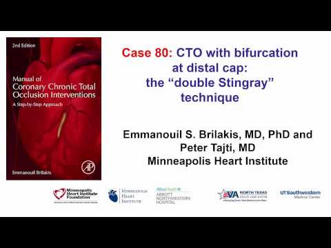 Case 80: Manual of CTO Interventions - Double Stingray