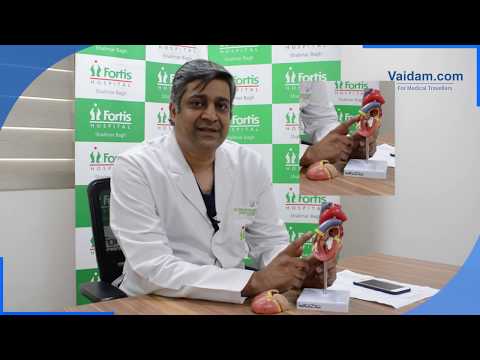 Pediatric Cardiac Surgeries Explained by Dr. Dinesh Mittal of Fortis Hospital, Shalimar Bagh