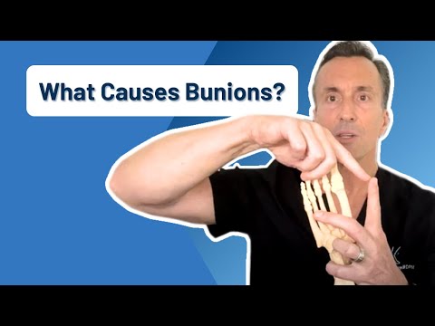 What is a Bunion Causes and Treatment Options
