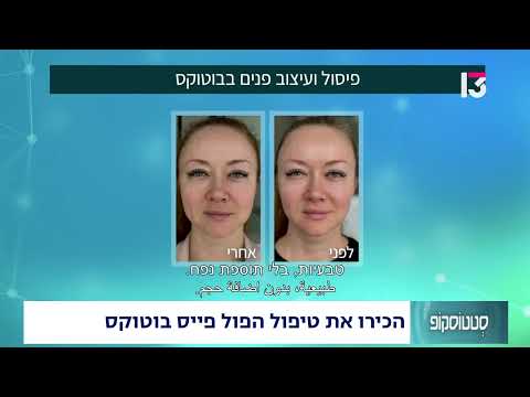  הכירו את טיפול פול פייס בוטוקוס
