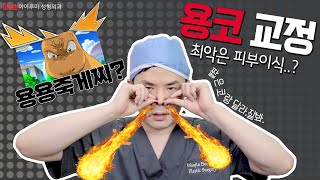 용코 교정 최악은 피부이식..? 제대로 용코 파헤치기