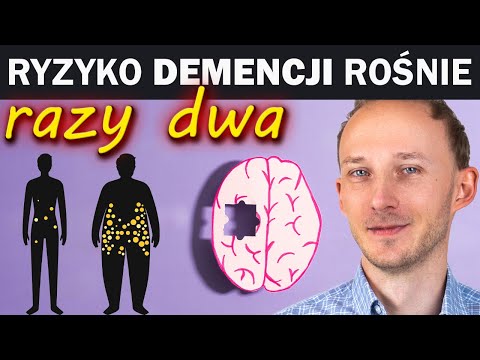 Te 10 rzeczy w życiu prowadzi do demencji i Alzheimera