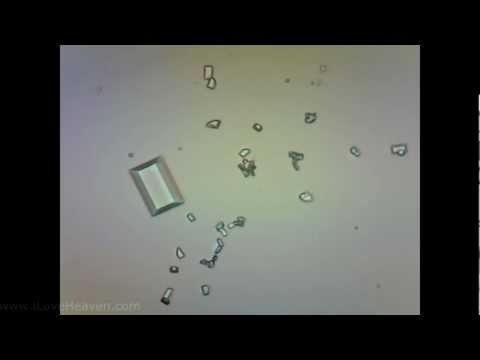 Struvite Crystals in Feline Urine Sample, Microscope Camera