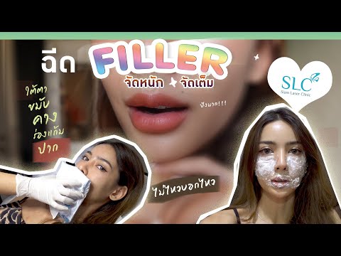 ฉีด ฟิลเลอร์ ปาก