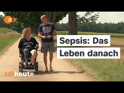 Sepsis: So gefährlich ist eine Blutvergiftung