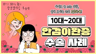 안검이완증 10대~20대 수술 사례