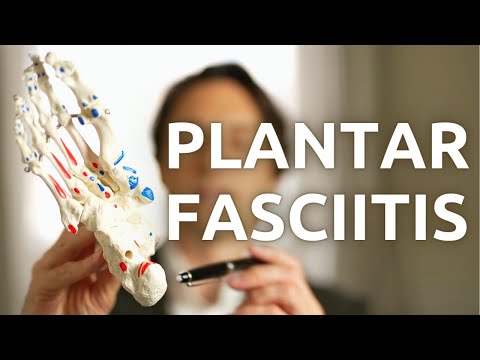 PLANTAR FASCIITIS - About this heel pain, the causes, how to examine and diagnose.